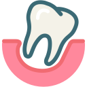 Лечение кисты зуба