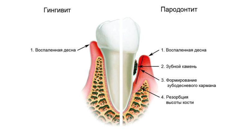 Зуб коренной фото строение